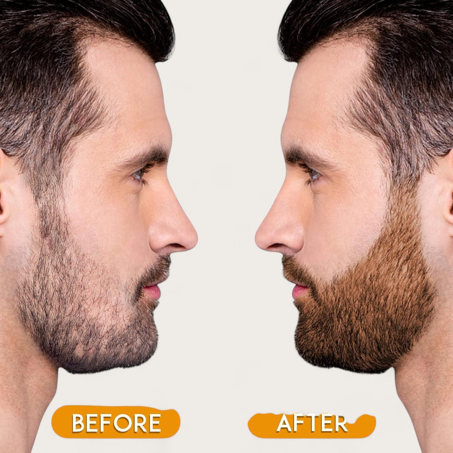 Männer Bart Pflege Kit – Bartfüllstift für einen perfekten, vollen Bart, Beard Filler Penkit - Kemberly® GmbH