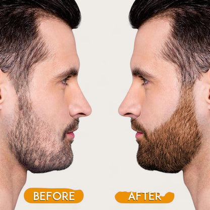 Männer Bart Pflege Kit – Bartfüllstift für einen perfekten, vollen Bart, Beard Filler Penkit - Kemberly® GmbH